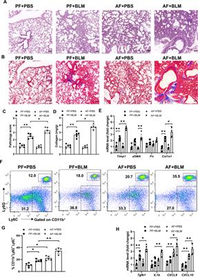 Alcohol-mediated susceptibility to lung fibrosis is associated with group 2 innate lymphoid cells in mice